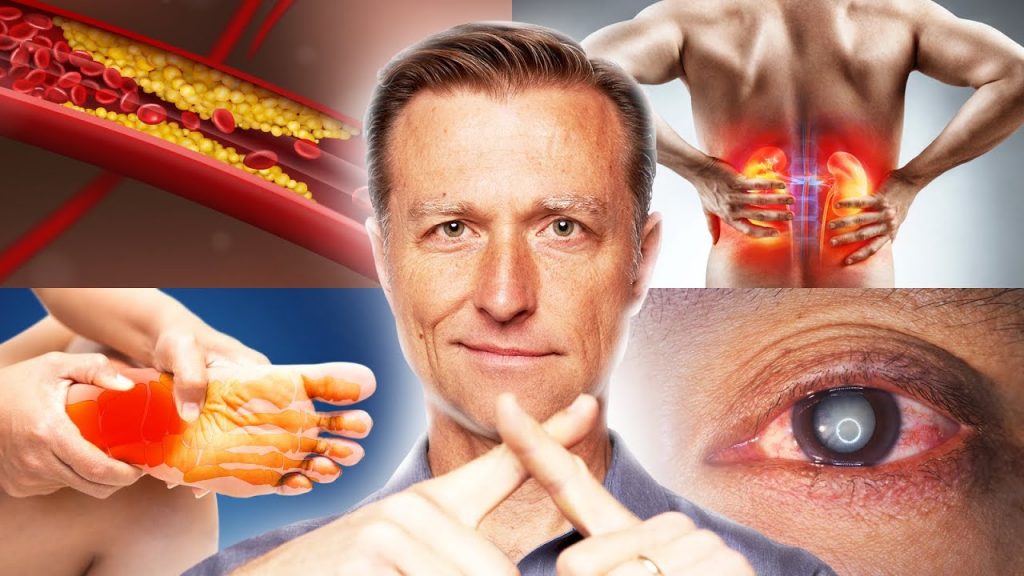 Take These 5 Vitamins To STOP Diabetic Complications Now