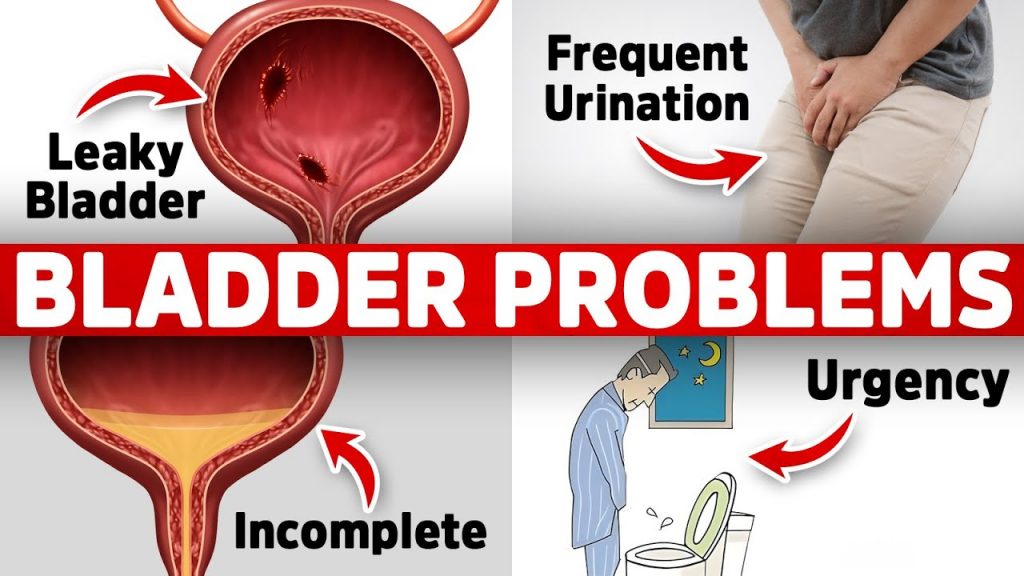 The #1 Vitamin Deficiency Behind Bladder Issues (Freq. Urination, Leaky, Urgency)