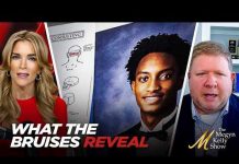 The Truth About Nolan Wells’ Alcohol Consumption and Bruises The Truth About Nolan Wells' Alcohol Consumption and Bruises